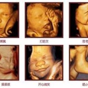 什么时候胎儿长得最快（胎儿胎心快是什么原因造成的啊？孕八个月多了，要做什么检查好）