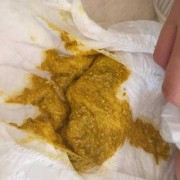 6个月宝宝大便有奶瓣是怎么回事？有奶瓣该怎么缓解,6个月的胎儿有多重,身长多少