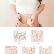 如何去肚子的妊娠纹,孕妇妊辰纹怎么去除