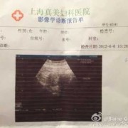 孕期周期（b超单显示的怀孕周数准确吗）