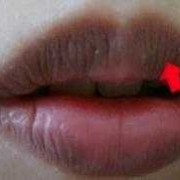 嘴唇发紫是什么原因引起的,孕期嘴唇发紫是什么原因造成的
