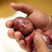 67天的胎儿有多大（67天的胎儿有多大图片）