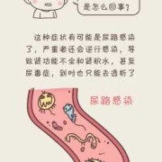 孕期可以憋尿吗（孕期憋尿会出现褐色分泌物吗）