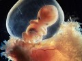 胎芽是什么,子宫胎儿图片