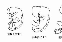 宝宝多大可以靠坐,胎儿坐高是什么意思