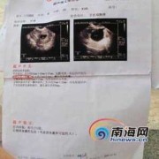 七周的胎儿图（孕七周B超显示五周，是不是代表胎儿发育不好）