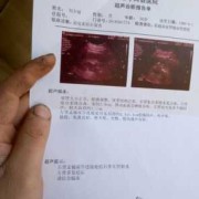 孕妇有肾结石怎么办,怀孕肾结石对胎儿有影响吗