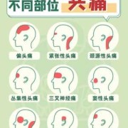 孕期偏头痛怎么办（偏头痛的原因及缓解方法）