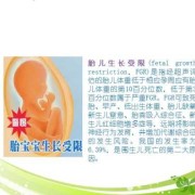 什么是胎儿生长受限（胎儿生长受限怎么办）