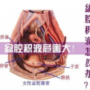 盆腔积液影响胎儿吗（怀孕了有盆腔积液怎么办）