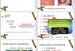 孕期过敏怎么办（大家知道孕妇为什么会对青霉素过敏呢）