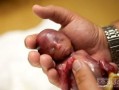 31周生下来的胎儿图（怀孕31周4天胎儿多大，有几斤重呢）