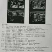 先天性肺囊腺瘤会变小吗,胎儿左肺囊腺瘤怎么办能治好吗