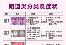 孕期的妇科病（孕妇得了霉菌性阴道炎怎么治疗）