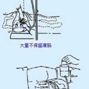 孕妇灌肠对胎儿的影响（孕妇灌肠对胎儿的影响）