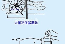 孕妇灌肠对胎儿的影响（孕妇灌肠对胎儿的影响）