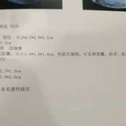 形态不规则有卵黄囊,胎儿不规则什么意思