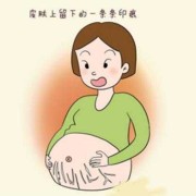 怀孕期间妊娠纹怎样能消除（怀孕期间妊娠纹怎样能消除掉）