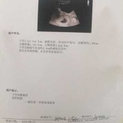 孕期胸积水（我怀孕了陶氏腔积液是怎么回事）