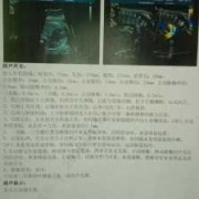 胎儿右心室强光斑原因（左室强光点是什么原因）