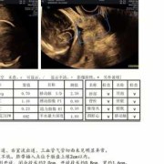 26周宫颈管26mm是不是太短了需要保胎吗,胎儿26mm是多大