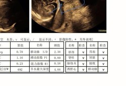 26周宫颈管26mm是不是太短了需要保胎吗,胎儿26mm是多大