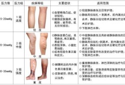 孕妇静脉曲张危险吗,孕期腿肿是什么原因引起的