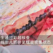 八月大的胎儿（八月大的胎儿有多重）