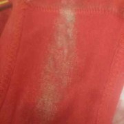 孕期白带腥（白带腥味重是怎么了）