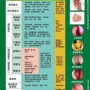 鼻炎引起咳嗽如何治疗怎么回事,孕期鼻炎咳嗽对胎儿有影响吗