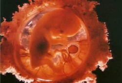 怀孕6个月胎儿多重（6周的胎儿有多大？怀孕六周有胎芽了吗）