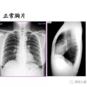 一次胸片不会影响胎儿（一次胸片不会影响胎儿）