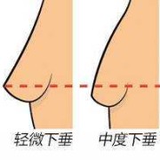 怀孕期间乳房会下垂吗（怀孕期间乳房会下垂吗图片）
