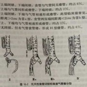 如何发现食管闭锁,胎儿食道闭锁的原因有哪些