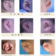 宝宝耳朵怎么会畸形的啊？怀孕期间需要注意哪些呢,吃什么会导致胎儿畸形吗