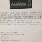胎儿超声心动图报告单（胎儿超声心动图报告单解读）