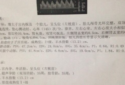 胎儿超声心动图报告单（胎儿超声心动图报告单解读）