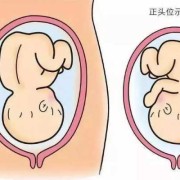 胎儿rot是什么胎位（胎儿ROT是什么胎位）