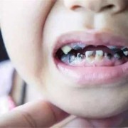 孕妇吃糖对胎儿的影响（孕妇吃糖对胎儿的影响）