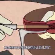 流产的胎儿怎么处理（流产的胎儿怎么处理）