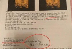 二十四周胎儿（孕24周侧脑室宽度标准）