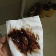 孕期就黑血（孕期黑血是好转吗）