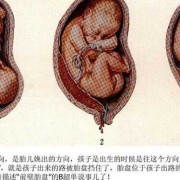 胎位不正对胎儿有影响吗（胎位不正对胎儿有影响吗视频）