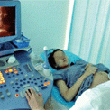 4d胎儿（4D胎儿彩超检查报告单）