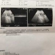 怀孕10周胎儿成型了吗（怀孕10周孕囊胎芽大小是多少，可以介绍下的吗）