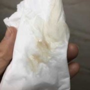 孕期咖啡色（怀孕初期有褐色的东西是什么原因）