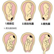胎位右枕前是什么意思呢,胎儿右枕前位图片示意图