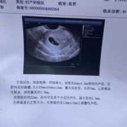 几个月长胎心和胎芽,怎么让胎儿长胎心胎芽呢