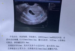 几个月长胎心和胎芽,怎么让胎儿长胎心胎芽呢