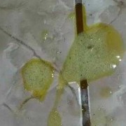 孕期流绿色分泌物（呕吐物为绿色液体什么状况）